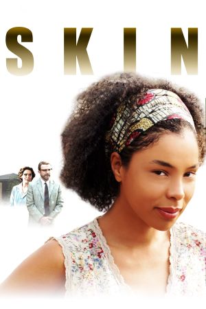 Skin – Schrei nach Gerechtigkeit hdfilme stream online